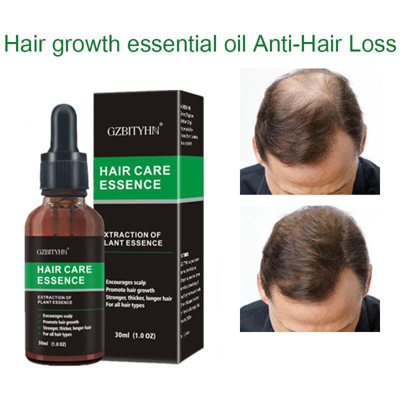 Aceite Esencial para el Crecimiento del Cabello
