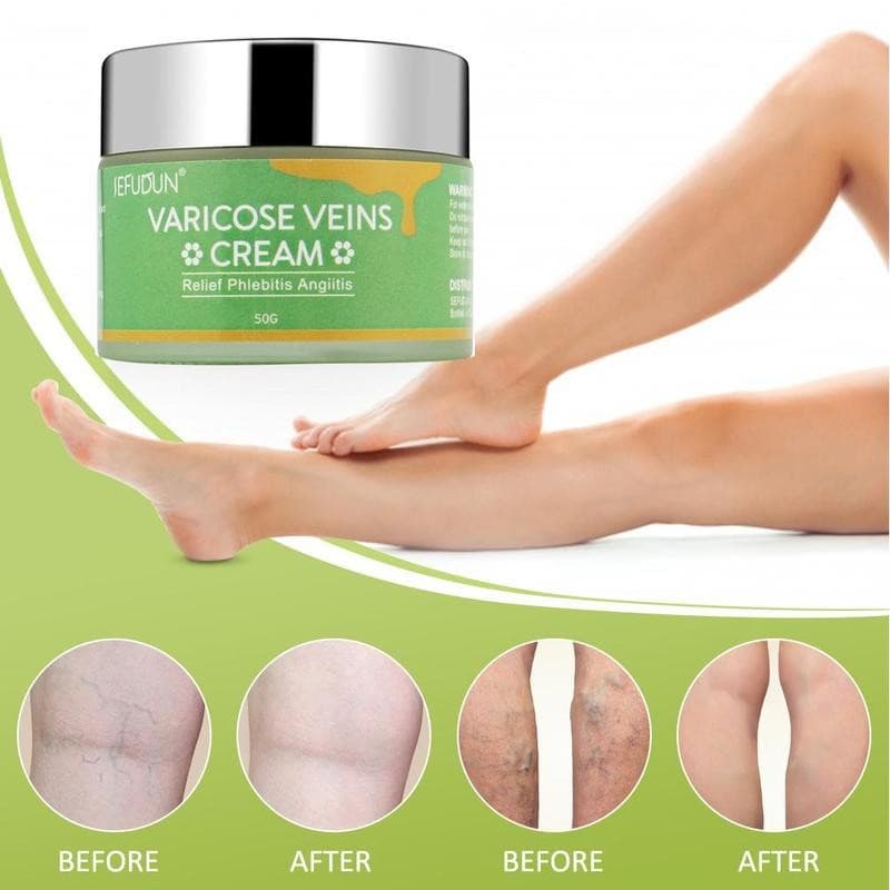 Crema Reparadora para Varices y Hematomas